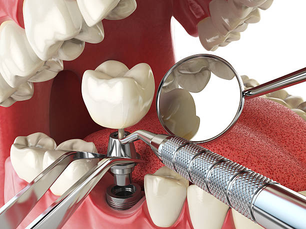 Best Emergency Dental Extractions in Luxemburg, WI